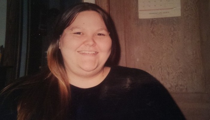 Mujer cambió más de 13 kilos de piel sobrante tras baja de peso por par de senos doble D