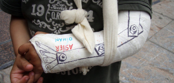 Ingenioso paramédico construye estructura para salvar brazo de niño en Curicó