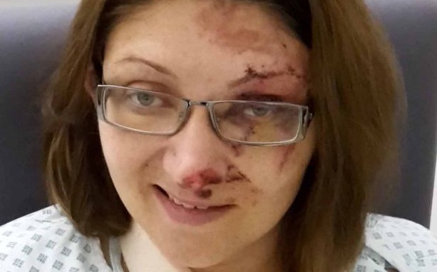 Mujer burló a la muerte cuando su auto quedó aplastado entre dos camiones en brutal choque