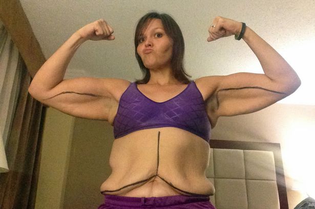 Tanya Benedict | Facebook