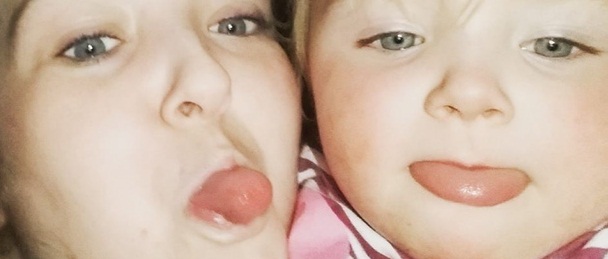 Escuchaban extraños ruidos en su casa: se encontraron con peligrosa sorpresa