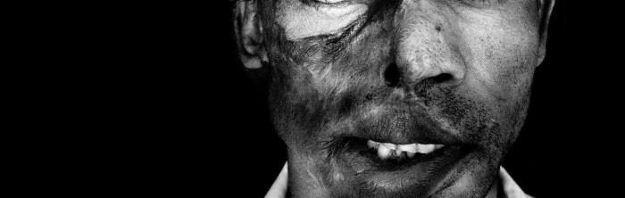 Video captó ataque con 'ácido' de un joven a un grupo de amigos sin mediar provocación