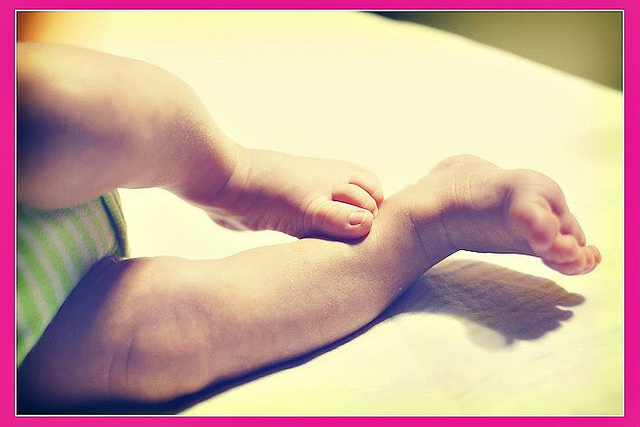 Conoce a la bebé que lucía como un alien cuando nació debido a una terrible condición