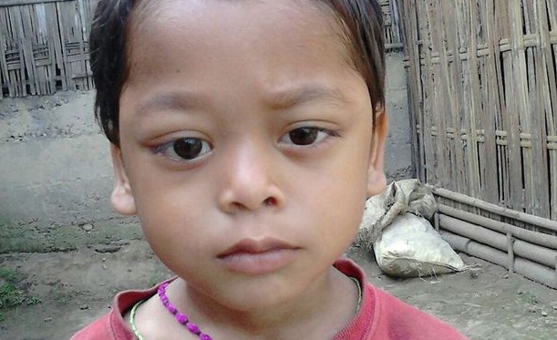 Agonía y dolor: La dramática historia de Sagar, el niño con cáncer que llora sangre