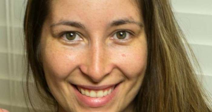 La cruda historia de vida que demuestra por qué debes usar protector solar