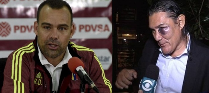 DT de Venezuela lesionó a un hombre tras ruda pelea en Uruguay