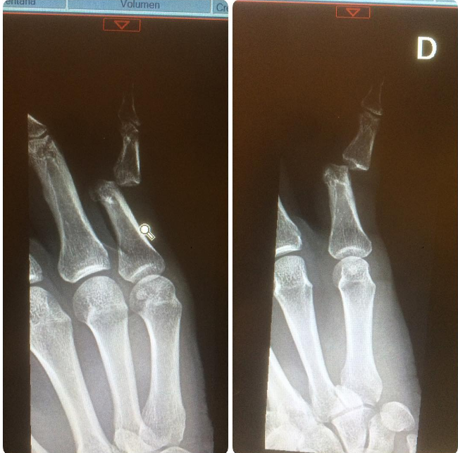 Álvaro Gómez / Instagram