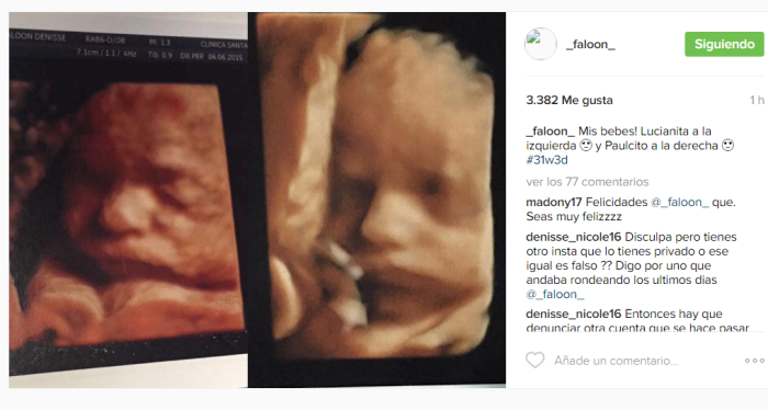 Faloon comparó ecografías de su hija y del bebé que viene ...