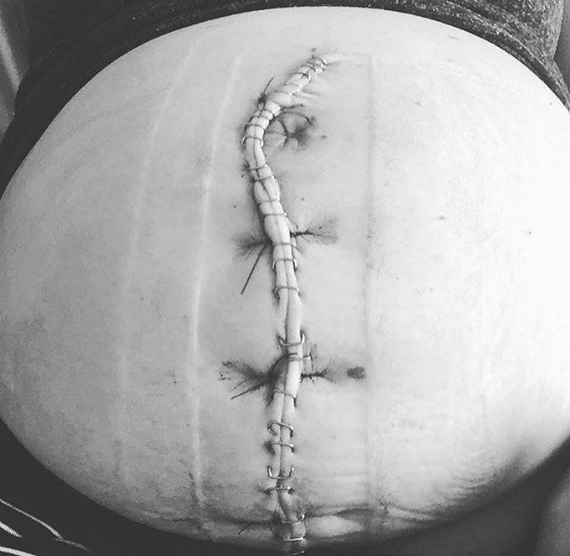 Birth Without Fear | Facebook