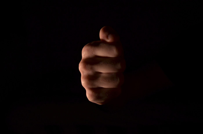 Hombre de 64 años murió tras recibir brutal combo por empujar accidentalmente a una mujer