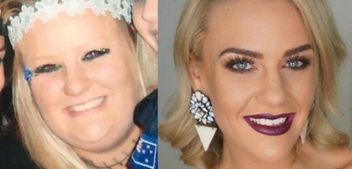 Joven bajó 92 kilos, se operó los labios y se puso relleno facial: luce irreconocible