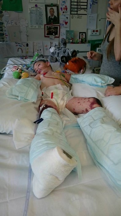 Kye-vinceable - Meningitis Journey | Facebook