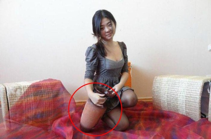 IMGUR