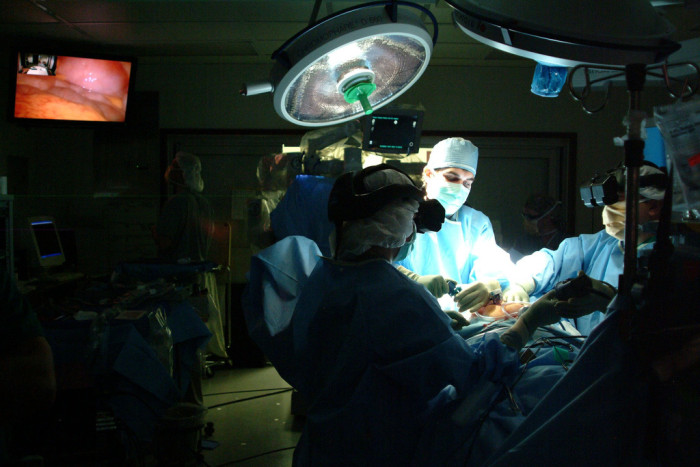 Hombre vivió más de 10 años con tumor de 60 kilos: médicos lo confundieron con obesidad