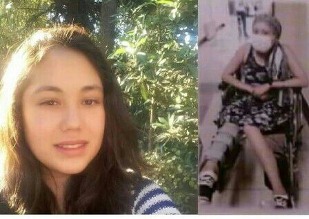 Enfermedad catastrófica: Familia pide ayuda para costear prótesis de 7 millones de pesos