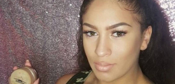 Joven dormía maquillada todos los días por miedo a que su novio la dejara: tiene vitiligo