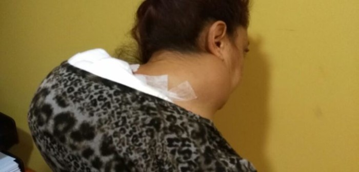 Mujer pide una vigésima operación debido a síndrome: le dijeron que no es prioridad