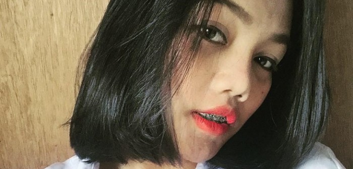 Joven reveló terrible cicatriz tras remoción de tatuaje para advertir a otros