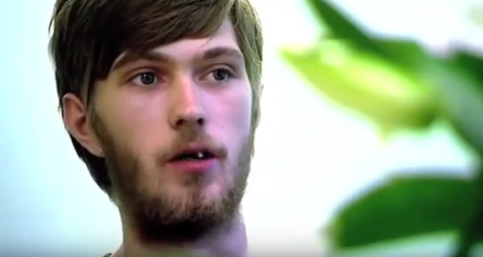 Joven pasó 20 años sin cepillarse los dientes: tuvieron que reconstruir su dentadura