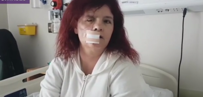 El fuerte reclamo de fiscalizadora del Transantiago atropellada a sujeto que la empujó