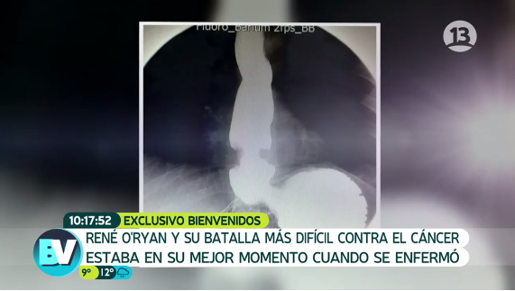 Captura | Canal 13