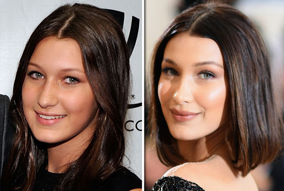 El increíble "antes y después" de Bella Hadid, la modelo más cotizada