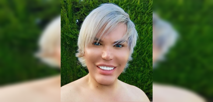 'Ken Humano' terminó con sus dientes destrozados tras asistir a la Milan Fashion Week