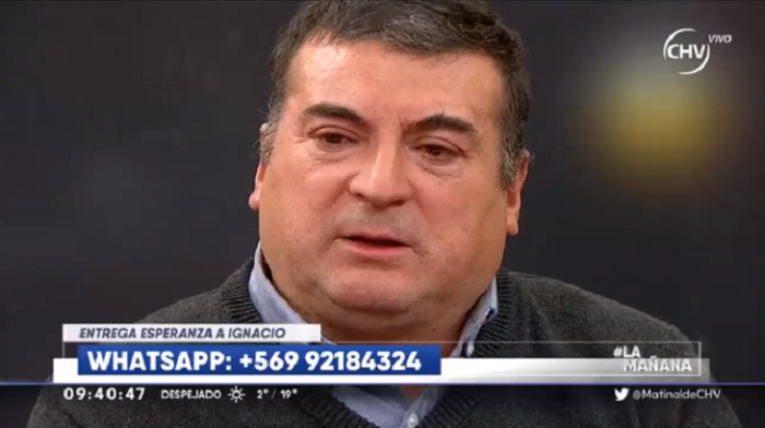 Relato de hombre que resultó con un 95% de su cuerpo quemado emocionó a panel de La Mañana