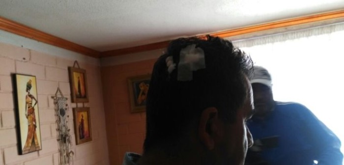 Clínica penquista se habría negado a atender a herido que fue asaltado frente al recinto