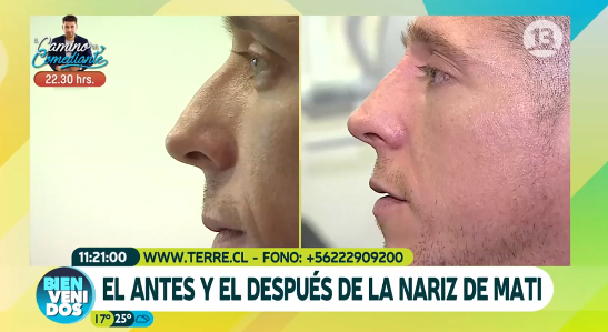 Canal 13 | Bienvenidos