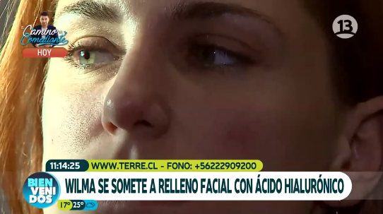 Canal 13 | Bienvenidos