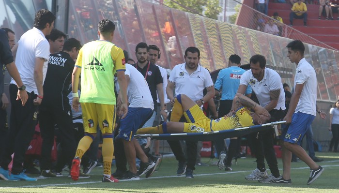 Sebastián Leyton sufrió brutal lesión en partido de Everton y Unión Española: se fracturó