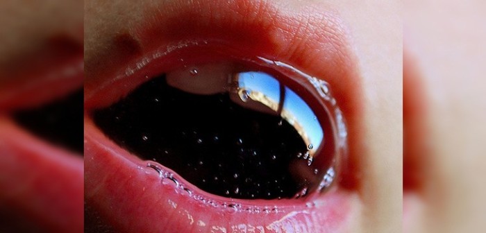 Para de sufrir: 5 simples trucos que te permitirán controlar el hipo