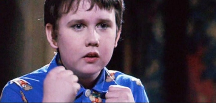 Le decían 'Neville Longbottom' por sus dientes: ahora su cambio es la mejor 'venganza'