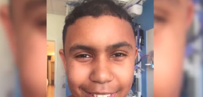 El catastrófico final que pudo haber tenido un joven tras clavarse tornillo en la cabeza