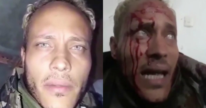 El desgarrador registro de “policía rebelde” que murió abatido por gobierno venezolano