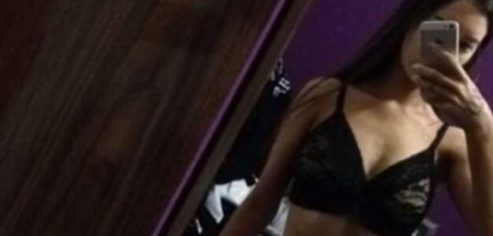 Dramático caso de joven anoréxica que vivió solo tomando té verde conmueve a las redes