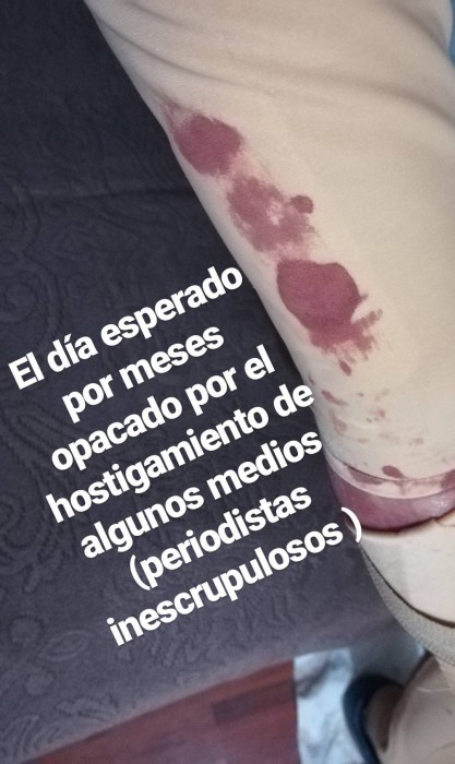 Ignacio Lastra | Instagram