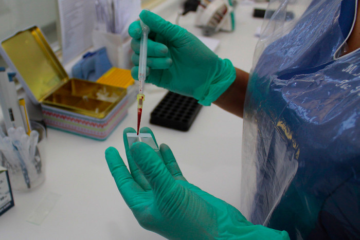 De urgencia: joven diagnosticada con Hanta en Coyhaique es trasladada hasta Santiago