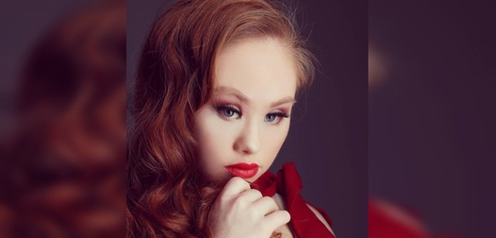 Revolucionó la industria: modelo con Síndrome de Down sorprende tras bajar 25 kilos