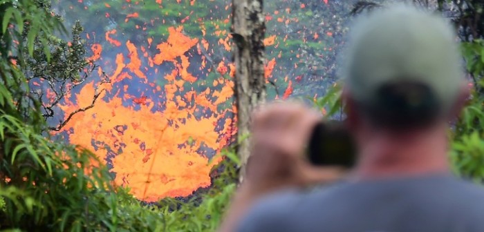 Hombre recibe salpicadura de lava en su pierna y termina internado en el hospital
