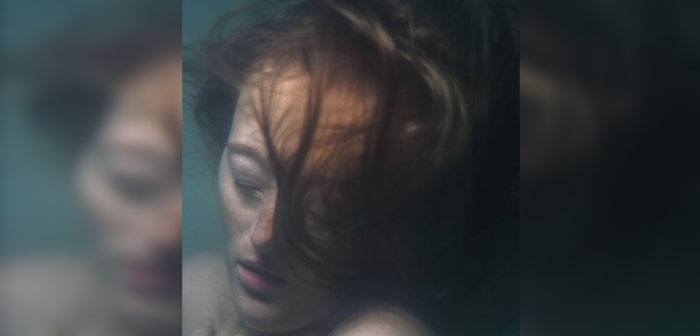 Fuera complejos: modelo de 26 años con malformación facial desafía lo establecido