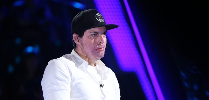 Ignacio Lastra publicó fotografía en primer plano de su cara con potente mensaje