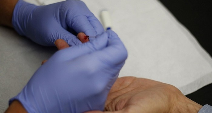 Paciente con VIH recibirá millonaria indemnización por ser notificado 3 años después