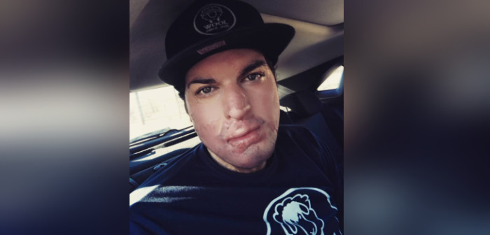 Tras recibir alta médica: Ignacio Lastra reveló las nuevas cirugías que deberá enfrentar