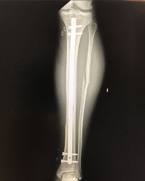 Maxi Ferres| Instagram