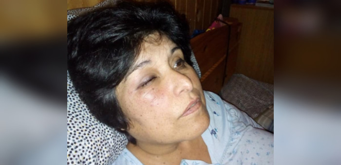 Con golpes y patadas: profesora denunció brutal ataque de alumno y apoderado en Cartagena