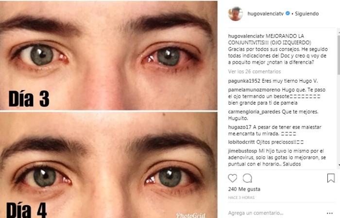 Hugo Valencia / Instagram
