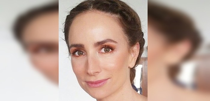 María José Prieto muestra el daño que sufrió tras ser picada por medusa en sus vacaciones