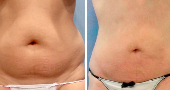 Captura | Youtube | Clínicas Diego de León